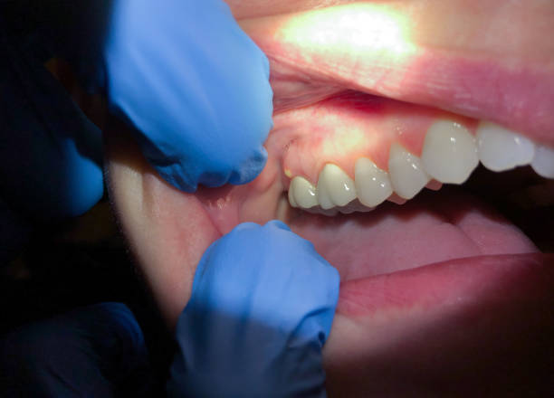 Best Cosmetic Emergency Dentistry in Fountain Valley, CA